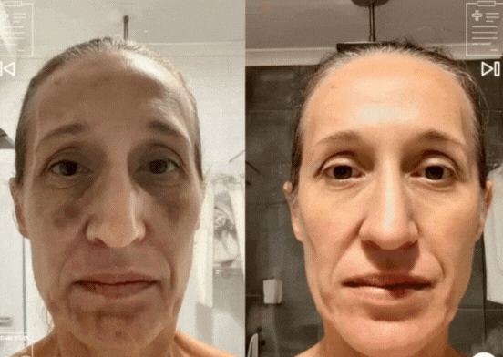 Descrição da imagem